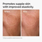 ordinary-hyaluronic-acid-2pct-b5-hydrating-serum-before-after-elasticity