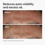 ordinary-niacinamide-zinc-blemish-serum-before-after-pores