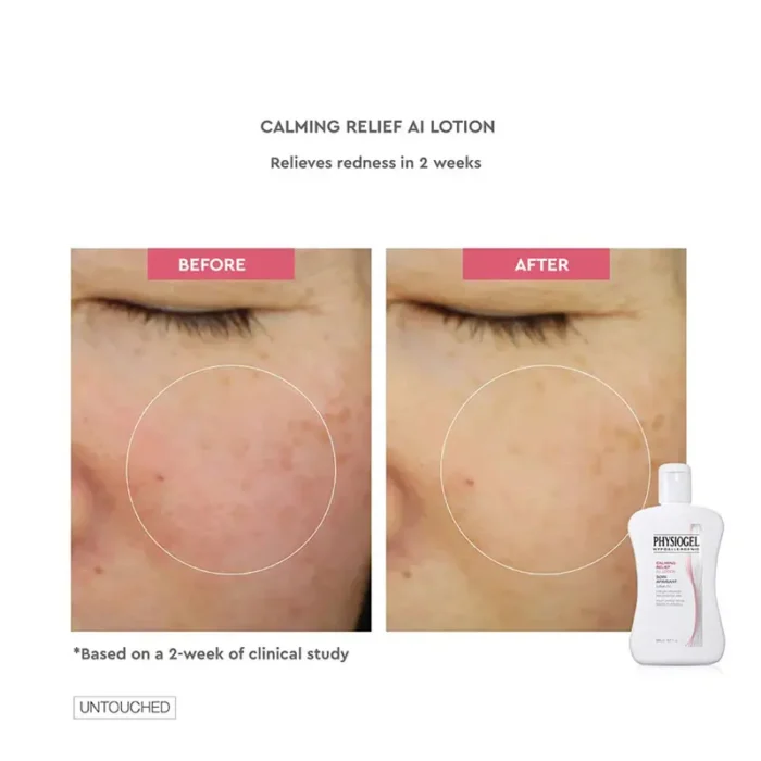 Physiogel Lotion Calming Relief AI - 200ml - Image 2