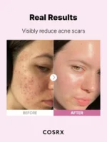 CosRx The Niacinamide 15 Serum - Image 7