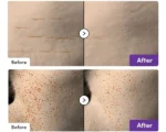 eqqualberry-bakuchiol-plumping-serum-results