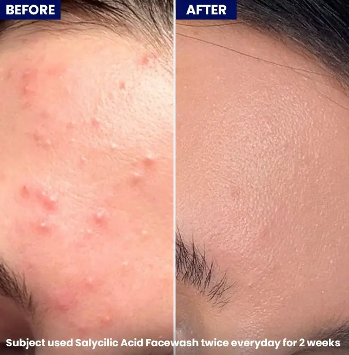 imgi_20_3rdimage_2fcf0c66-99b5-4040-b5e4-7ff09e5aaf76