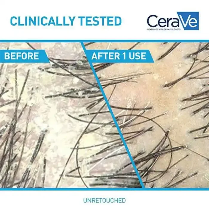 cerave-anti-dandruff-hydrating-conditioner-2