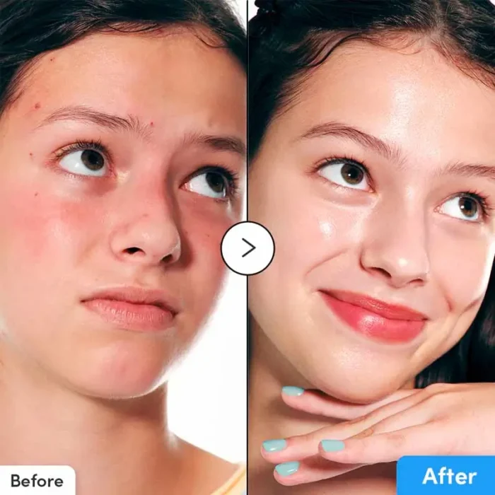 eqqualberry-hyaltoin-flooding-serum-3