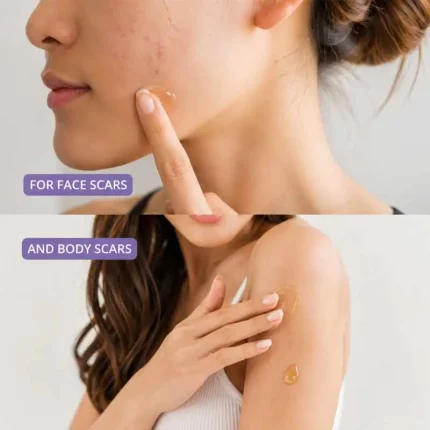 hudson-skincare-hudson-scar-gel-3