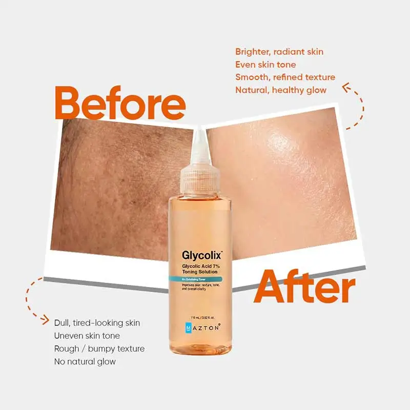 mazton-glycolix-toner-2 mazton-glycolix-toner-2